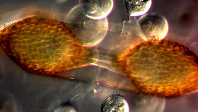 Odontella sinensis | © Koninklijk NIOZ, www.nioz.nl