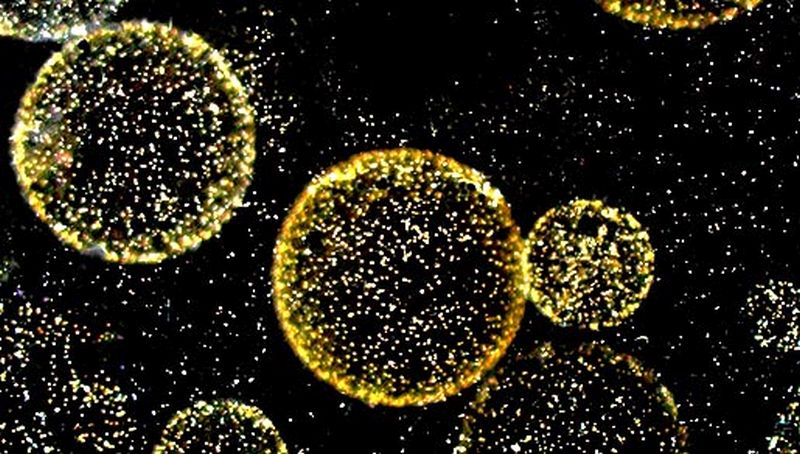 Phaeocystis globosa | © Koninklijk NIOZ, www.nioz.nl