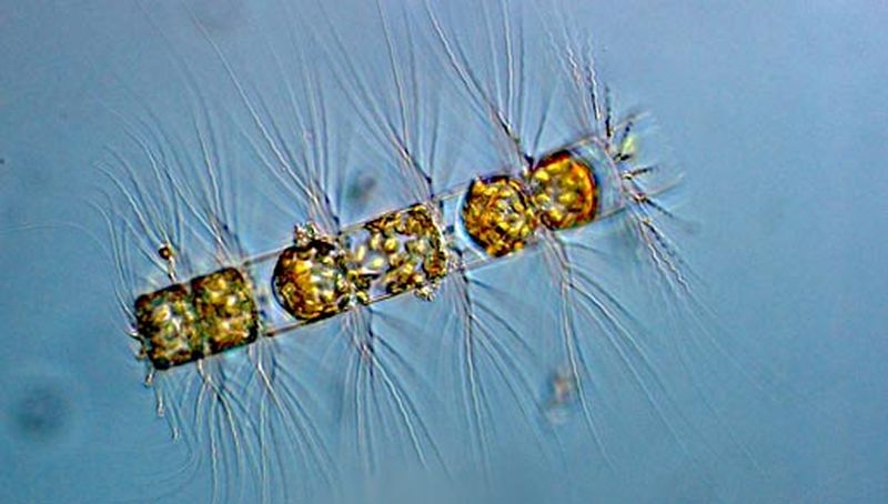 Bacteriastrum hyalinum | © Koninklijk NIOZ, www.nioz.nl