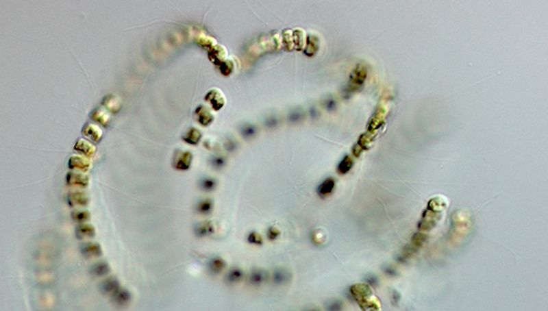 Chaetoceros socialis | © Koninklijk NIOZ, www.nioz.nl